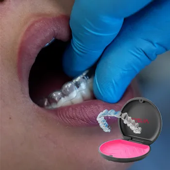 INVISALIGN featured image