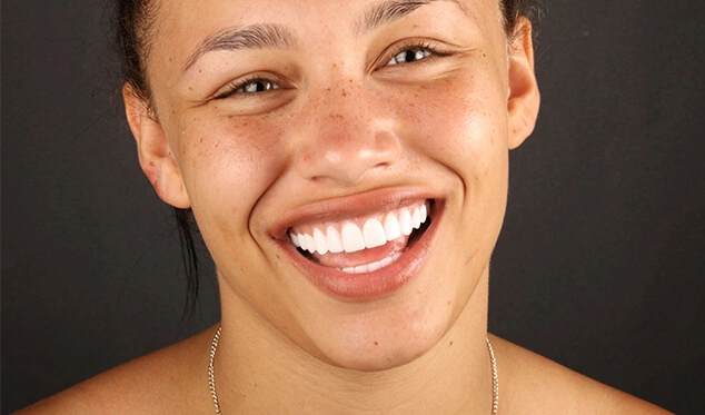 HOLLYWOOD SMILE featured image