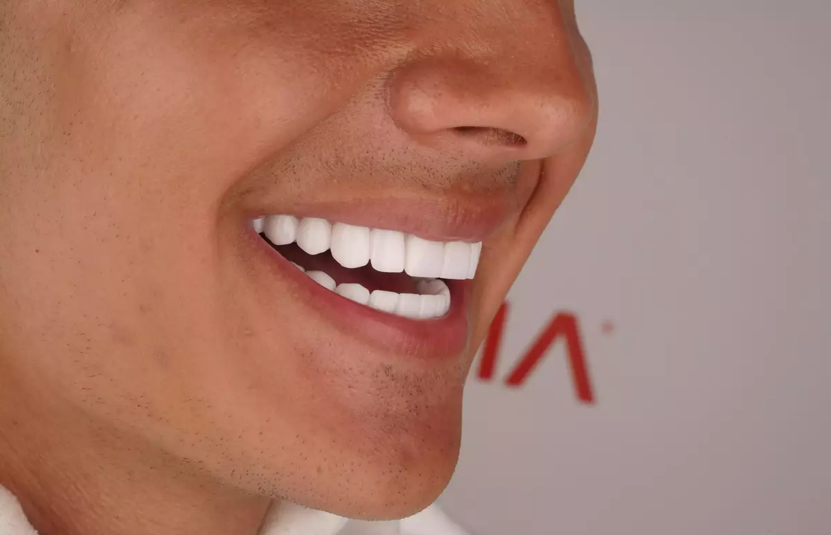 RÉSOLUTION DU SOURIRE GINGIVAL featured image