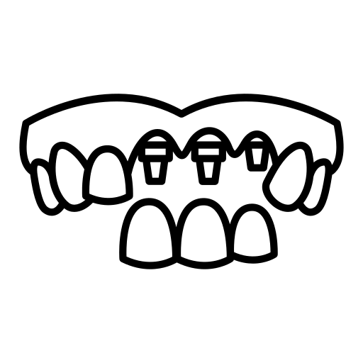 Скуловые, птеригоидные и трансназальные импланты icon